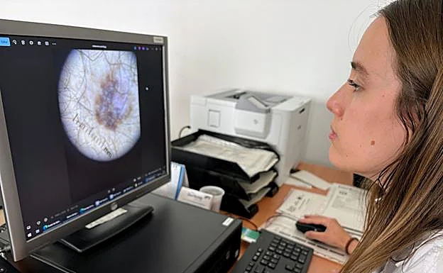 Orihuela incorpora la teledermatología en sus centros de salud para agilizar el diagnóstico de lesiones cutáneas